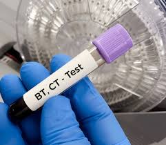Bleeding Time (BT) and Clotting Time (CT) tests